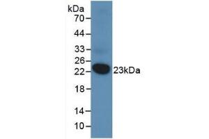 Detection of Recombinant DUSP3, Human using Monoclonal Antibody to Dual Specificity Phosphatase 3 (DUSP3) (Dual Specificity Phosphatase 3 (DUSP3) (AA 2-185) antibody)