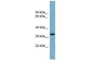 WB Suggested Anti-OTUD6B Antibody Titration: 0. (OTUD6B antibody  (Middle Region))