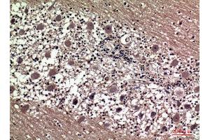 Immunohistochemistry (IHC) analysis of paraffin-embedded Human Brain, antibody was diluted at 1:100. (Prolactin antibody  (Internal Region))