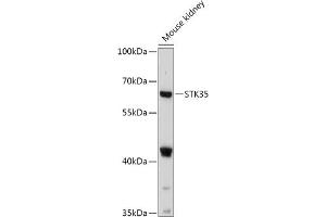 Western blot analysis of extracts of Mouse kidney, using STK35 antibody (ABIN7270225) at 1:1000 dilution. (STK35 antibody  (AA 190-380))