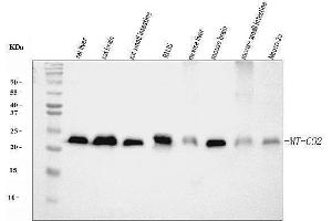 Western blot analysis of MT-CO2 using anti-MT-CO2 antibody (ABIN7599081).