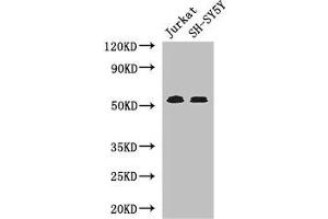 Western Blot Positive WB detected in: Jurkat whole cell lysate, SH-SY5Y whole cell lysate All lanes: TGFBR1 antibody at 4 μg/mL Secondary Goat polyclonal to rabbit IgG at 1/50000 dilution Predicted band size: 56, 57, 48 kDa Observed band size: 56 kDa (TGFBR1 antibody  (AA 157-244))