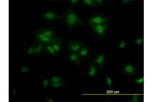 Immunofluorescence of monoclonal antibody to TCF7L2 on HeLa cell. (TCF7L2 antibody  (AA 490-596))