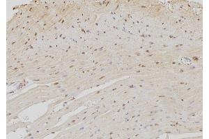 ABIN6273372 at 1/100 staining Rat heart tissue by IHC-P. (NOC4L antibody  (Internal Region))