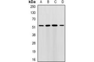 Western blot analysis of RMDN3 expression in HepG2 (A), MCF7 (B), mouse liver (C), mouse brain (D) whole cell lysates. (RMDN3 antibody)