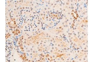Immunohistochemistry (IHC) image for anti-Checkpoint Kinase 2 (CHEK2) (pThr383) antibody (ABIN6256552)