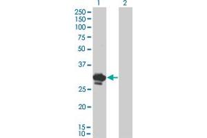 Western Blot analysis of BDNF expression in transfected 293T cell line by BDNF monoclonal antibody (M02), clone 1B10. (BDNF antibody  (AA 1-247))