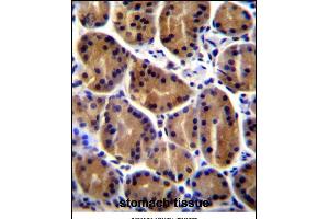 PKP2 Antibody (C-term) (ABIN656864 and ABIN2846068) immunohistochemistry analysis in formalin fixed and paraffin embedded human stomach tissue followed by peroxidase conjugation of the secondary antibody and DAB staining. (Plakophilin 2 antibody  (C-Term))