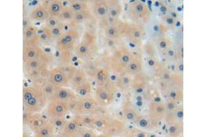 Used in DAB staining on fromalin fixed paraffin-embedded liver tissue (AGMAT antibody  (AA 205-347))