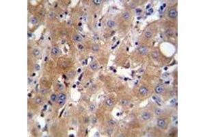 TRPM8 antibody immunohistochemistry analysis in formalin fixed and paraffin embedded human liver tissue. (TRPM8 antibody  (AA 263-292))