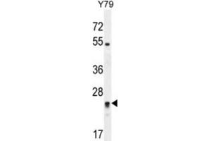 Western Blotting (WB) image for anti-Deleted in Primary Ciliary Dyskinesia Homolog (DPCD) antibody (ABIN2995873) (DPCD antibody)