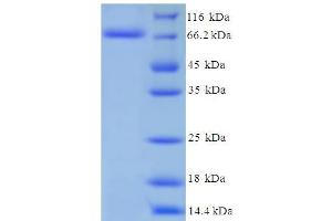 SDS-PAGE (SDS) image for Cytochrome P450, Family 11, Subfamily A, Polypeptide 1 (CYP11A1) (AA 40-521) protein (His-SUMO Tag) (ABIN5709377)