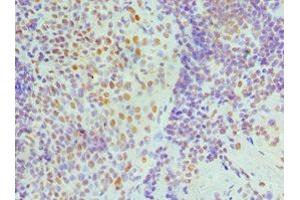 Immunohistochemistry of paraffin-embedded human tonsil tissue using ABIN7161690 at dilution of 1:100 (NONO antibody  (AA 1-300))