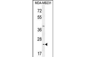 SYCE2 Antibody (N-term) (ABIN654371 and ABIN2844127) western blot analysis in MDA-M cell line lysates (35 μg/lane). (SYCE2 antibody  (N-Term))