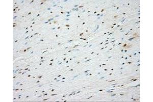 Immunohistochemical staining of paraffin-embedded Kidney tissue using anti-BTK mouse monoclonal antibody. (BTK antibody)