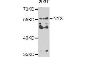 Western blot analysis of extracts of 293T cells, using NYX antibody. (Nyctalopin antibody)