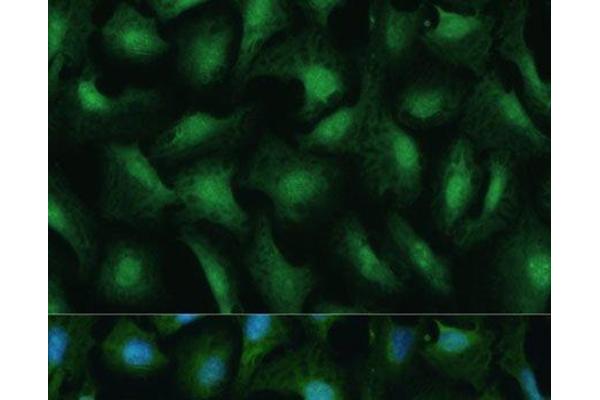 DDX3Y antibody