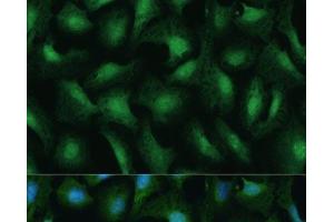 Immunofluorescence analysis of U-2 OS cells using DDX3Y Polyclonal Antibody at dilution of 1:100 (40x lens).