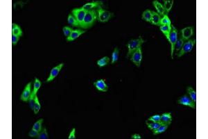 Immunofluorescent analysis of HepG2 cells using ABIN7158114 at dilution of 1:100 and Alexa Fluor 488-congugated AffiniPure Goat Anti-Rabbit IgG(H+L) (LRRTM4 antibody  (AA 259-419))