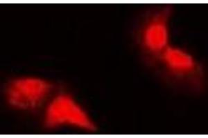 Immunofluorescent analysis of HER2 staining in MCF cells. (ErbB2/Her2 antibody  (C-Term))