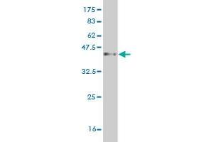 Western Blot detection against Immunogen (37. (Protocadherin 1 antibody  (AA 62-169))