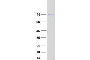 Validation with Western Blot