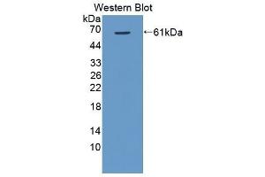 Western Blotting (WB) image for anti-VEGF Receptor 2 (VEGFR2) (AA 8-290) antibody (ABIN3206769) (VEGFR2/CD309 antibody  (AA 8-290))