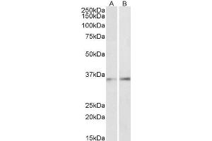 ABIN1590012 (1µg/ml) staining of Human Skin (A) and Pig Lung (B) lysates (35µg protein in RIPA buffer). (CEBPB antibody  (AA 68-81))