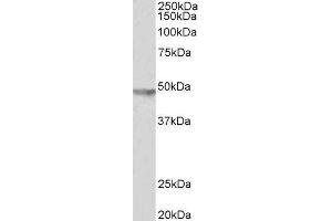 ABIN2562824 (2µg/ml) staining of Human Brain (Substantia Nigra) lysate (35µg protein in RIPA buffer). (KCNJ6 antibody  (C-Term))