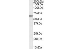 Western Blotting (WB) image for anti-Glycine/Arginine Rich Protein 1 (GRRP1) (N-Term) antibody (ABIN2156807) (GRRP1 antibody  (N-Term))