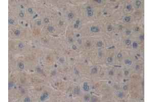 Detection of PACAP in Human Liver Tissue using Polyclonal Antibody to Pituitary Adenylate Cyclase Activating Peptide (PACAP) (Pituitary Adenylate Cyclase Activating Peptide (AA 17-176) antibody)