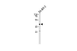 Western blot analysis in SK-BR-3 cell line lysates (35ug/lane).