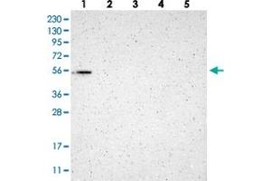 Western blot analysis of Lane 1: RT-4, Lane 2: Human Plasma, Lane 3: U-251 MG, Lane 4: Liver, Lane 5: Tonsil with GMEB2 polyclonal antibody  at 1:250-1:500 dilution. (GMEB2 antibody)