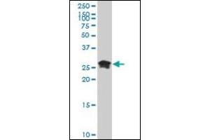 Western Blotting (WB) image for anti-High Mobility Group Box 2 (HMGB2) (AA 1-196) antibody (ABIN614619) (HMGB2 antibody  (AA 1-196))