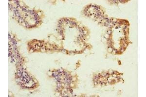 Immunohistochemistry of paraffin-embedded human small intestine tissue using ABIN7144845 at dilution of 1:100 (ATP5H antibody  (AA 1-161))