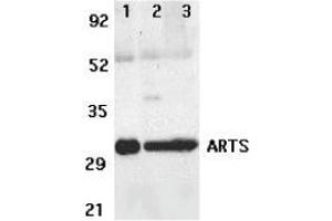 Western blot analysis of ARTS expression in human lung (lane 1), spleen (lane 2), and kidney (lane 3) tissue lysates with AP30082PU-N ARTS antibody at 2 μg /ml. (ARTS antibody)