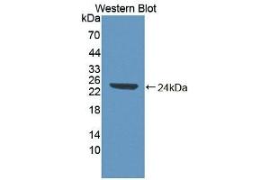 Detection of Recombinant ABI1, Human using Polyclonal Antibody to Abl Interactor 1 (ABI1)