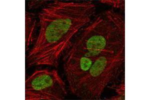 Confocal immunofluorescence analysis of Hela cells using MLH1 mouse mAb (green), showing nuclear localization.