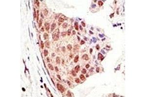 Immunohistochemistry (IHC) image for anti-Small Ubiquitin Related Modifier Protein 1 (SUMO1) (AA 55-86) antibody (ABIN3032769)