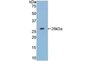 Detection of Recombinant RARa, Mouse using Polyclonal Antibody to Retinoic Acid Receptor Alpha (RARa) (Retinoic Acid Receptor alpha antibody  (AA 237-459))