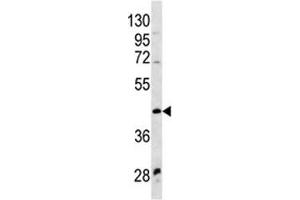 WNT9A antibody western blot analysis in NCI-H460 lysate (WNT9A antibody  (AA 216-244))