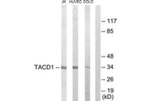 Western blot analysis of extracts from Jurkat/HuvEc/COLO205 cells, using TACD1 Antibody. (TACD1 (AA 116-165) antibody)