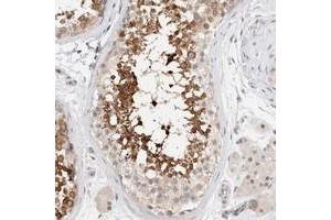 Immunohistochemical staining of human testis with C17orf97 polyclonal antibody  shows strong cytoplasmic positivity in subsets of seminiferus duct cells. (LIAT1/C17orf97 antibody)