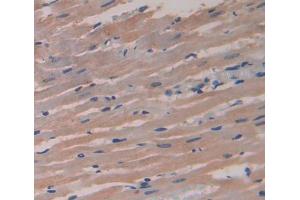 Used in DAB staining on fromalin fixed paraffin- embedded heart tissue (DMPK antibody  (AA 1-152))