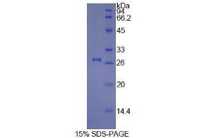 SDS-PAGE (SDS) image for Collagen, Type I, alpha 1 (COL1A1) (AA 253-471) protein (His tag) (ABIN1079227)
