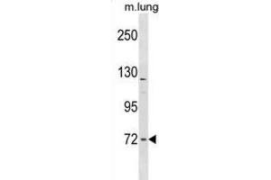 Western Blotting (WB) image for anti-Formin Binding Protein 1-Like (FNBP1L) antibody (ABIN2998844)