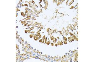 Immunohistochemistry (IHC) image for anti-Proteasome Subunit alpha  7 (PSMA7) (AA 1-248) antibody (ABIN1682332)