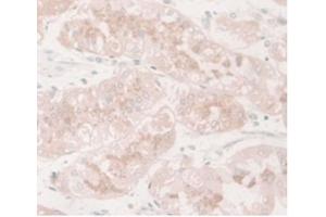 DAB staining on IHC-P, Samples: Human Stomach Tissue. (CD73 antibody  (AA 29-500))