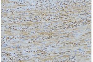 ABIN6275293 at 1/100 staining Mouse muscle tissue by IHC-P. (NEURL2 antibody  (Internal Region))