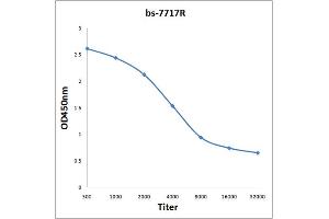 Antigen: 0. (CDCA5 antibody  (AA 101-200))